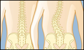 Can An Unhealthy Spine Affect Internal Organs?